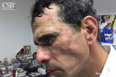 Golpeado por la Guardia Nacional gobernador Henrique Capriles durante manifestación en Caracas